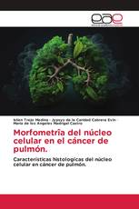 Morfometrîa del núcleo celular en el cáncer de pulmón.