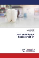 Post Endodontic Reconstruction