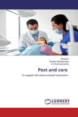 Post and core