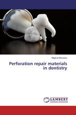 Perforation repair materials in dentistry