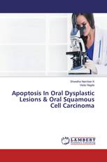 Apoptosis In Oral Dysplastic Lesions & Oral Squamous Cell Carcinoma