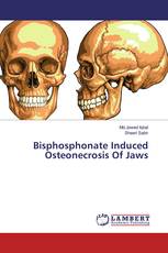 Bisphosphonate Induced Osteonecrosis Of Jaws