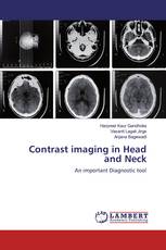 Contrast imaging in Head and Neck