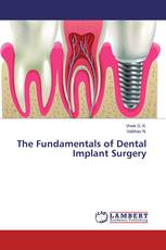 The Fundamentals of Dental Implant Surgery