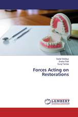 Forces Acting on Restorations