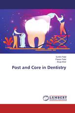 Post and Core in Dentistry