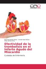 Efectividad de la trombolisis en el Infarto Agudo del Miocardio