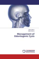 Management of Odontogenic Cysts