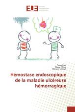 Hémostase endoscopique de la maladie ulcéreuse hémorragique