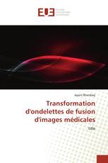 Transformation d'ondelettes de fusion d'images médicales