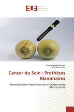 Cancer du Sein : Prothèses Mammaires