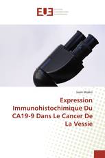 Expression Immunohistochimique Du CA19-9 Dans Le Cancer De La Vessie