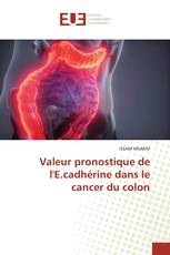 Valeur pronostique de l'E.cadhérine dans le cancer du colon