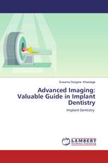 Advanced Imaging: Valuable Guide in Implant Dentistry