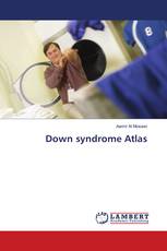 Down syndrome Atlas