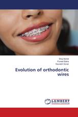 Evolution of orthodontic wires