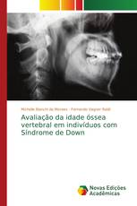 Avaliação da idade óssea vertebral em indivíduos com Síndrome de Down