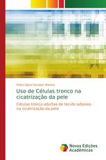 Uso de Células tronco na cicatrização da pele