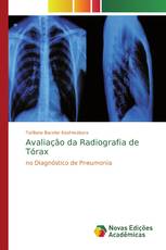 Avaliação da Radiografia de Tórax