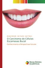 O Carcinoma de Células Escamosas Bucal