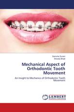 Mechanical Aspect of Orthodontic Tooth Movement