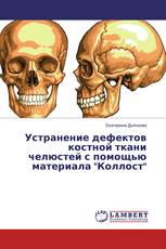Устранение дефектов костной ткани челюстей с помощью материала "Коллост"