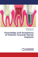 Knowledge and Acceptance of Patients Towards Dental Implants