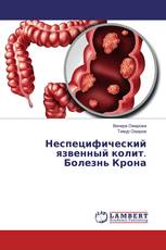 Неспецифический язвенный колит. Болезнь Крона