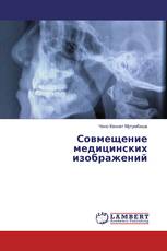 Совмещение медицинских изображений