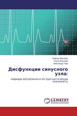 Дисфункции синусного узла: