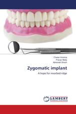 Zygomatic implant