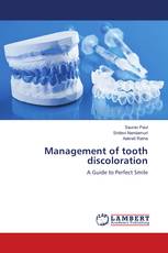 Management of tooth discoloration