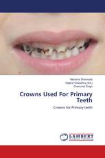 Crowns Used For Primary Teeth