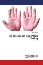 Hand Eczema and Patch Testing