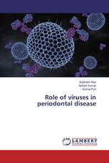 Role of viruses in periodontal disease