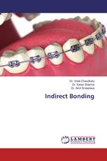 Indirect Bonding