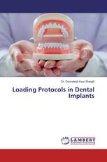 Loading Protocols in Dental Implants