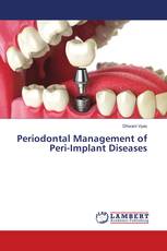 Periodontal Management of Peri-Implant Diseases