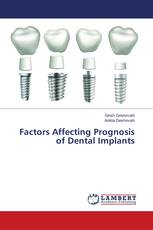 Factors Affecting Prognosis of Dental Implants