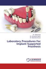 Laboratory Procedures For Implant Supported Prosthesis