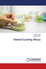 Dental Casting Alloys