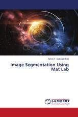 Image Segmentation Using Mat Lab