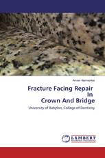 Fracture Facing Repair In Crown And Bridge