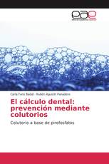 El cálculo dental: prevención mediante colutorios