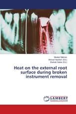 Heat on the external root surface during broken instrument removal