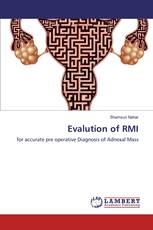 Evalution of RMI