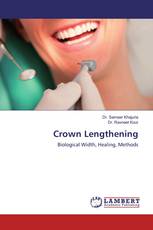 Crown Lengthening