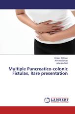 Multiple Pancreatico-colonic Fistulas, Rare presentation