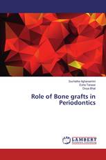 Role of Bone grafts in Periodontics