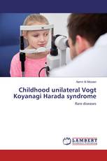 Childhood unilateral Vogt Koyanagi Harada syndrome